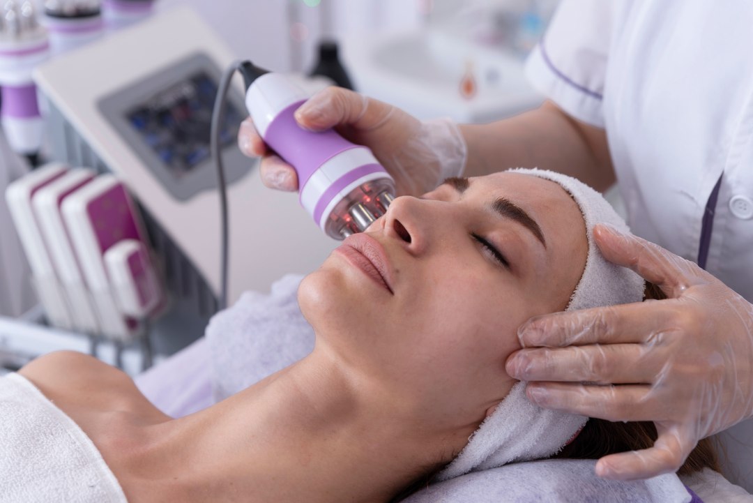 Radiofrecuencia facial